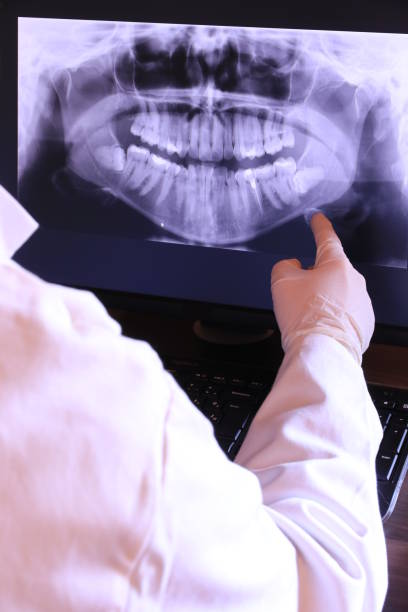 Best Emergency Tooth Extraction in Livonia, LA