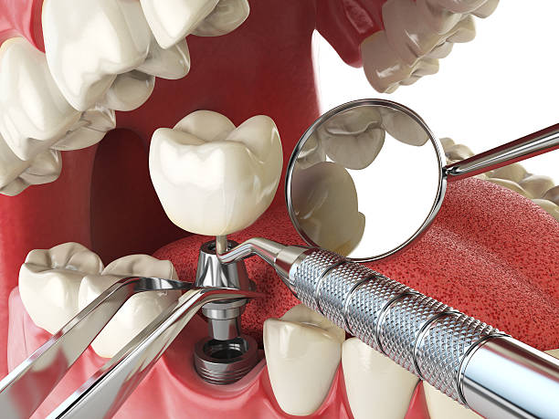 Best Emergency Dental Care for Trauma or Injury in Livonia, LA