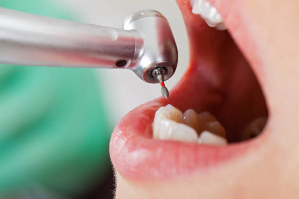 Best Emergency Dental Surgery in Livonia, LA